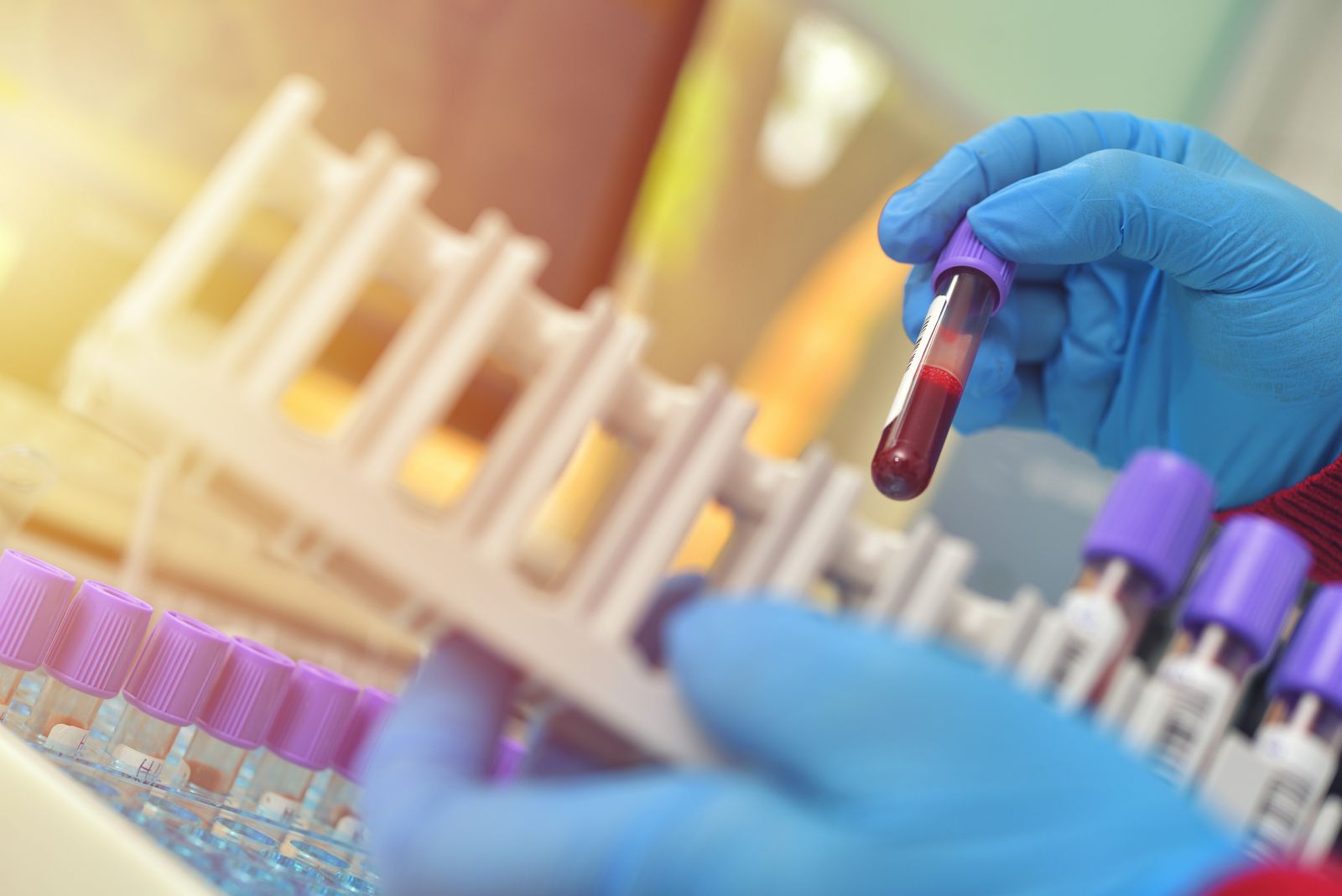 Détecter plus vite et à moindre coût les infections du sang