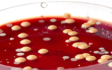 Elastic Light Scattering for low cost and non-destructive clinical pathogens identification